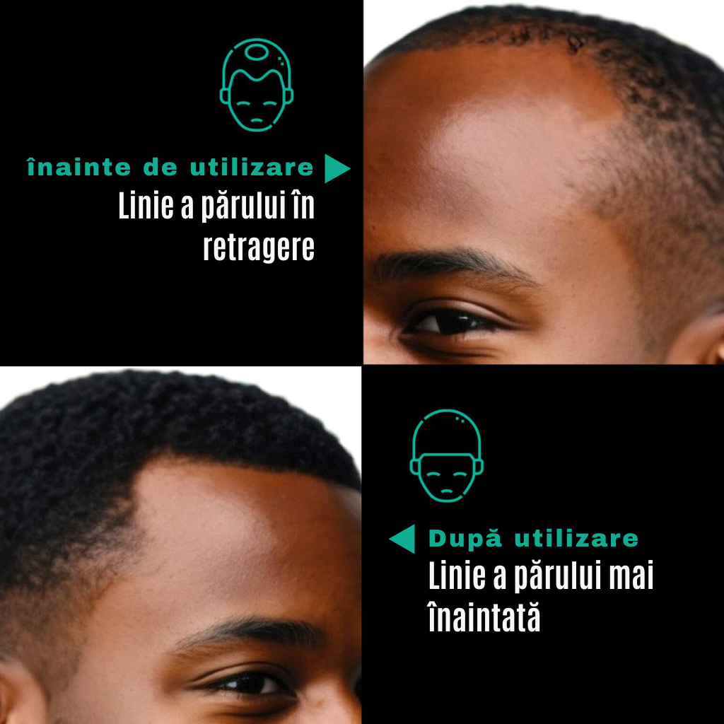 ULEI DE BATANA Shirazo™